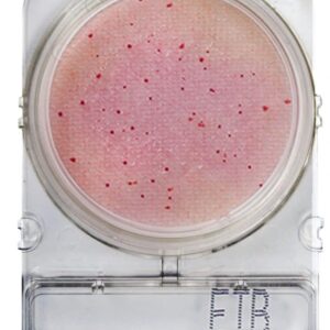 Compact Dry - Microbiología Superficies - Enterobacterias